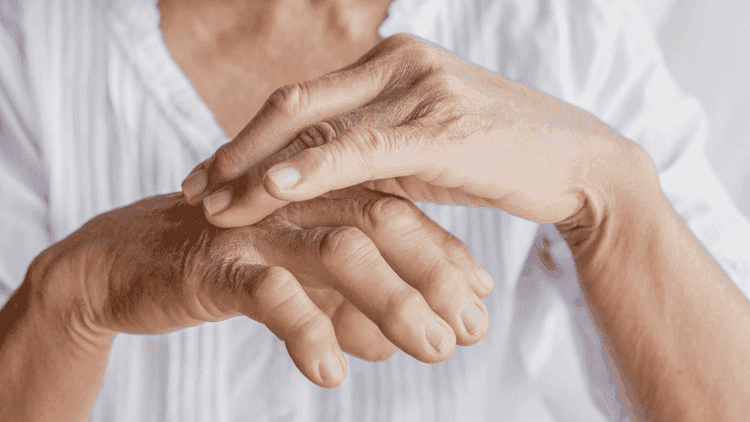 Asam Urat Tinggi atau Hiperurisemia.png