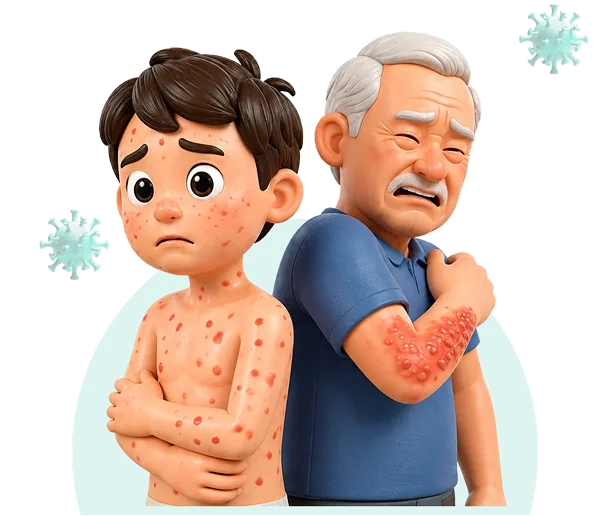 Ilustrasi cacar air dan cacar ular