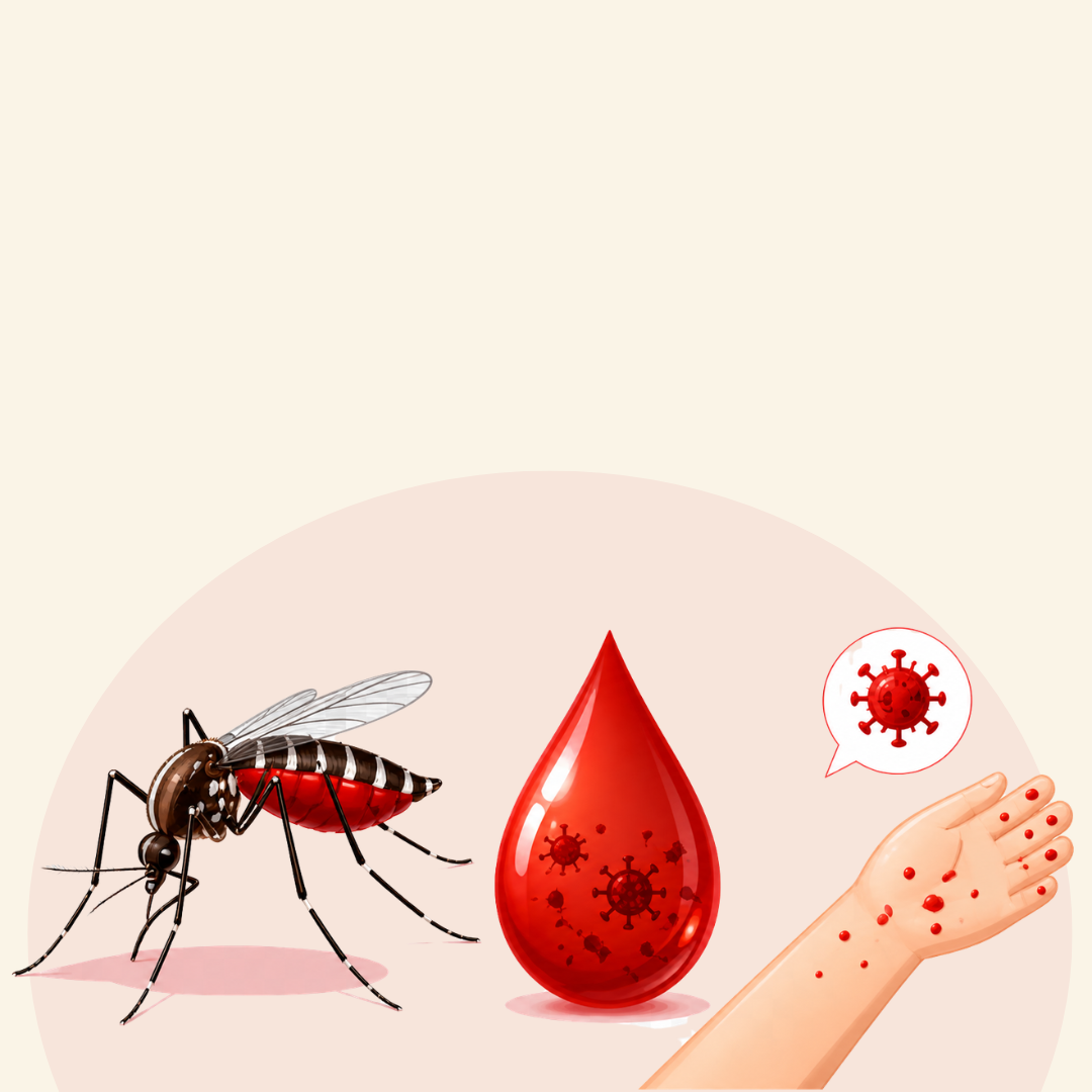 Demam Berdarah Dengue (DBD)