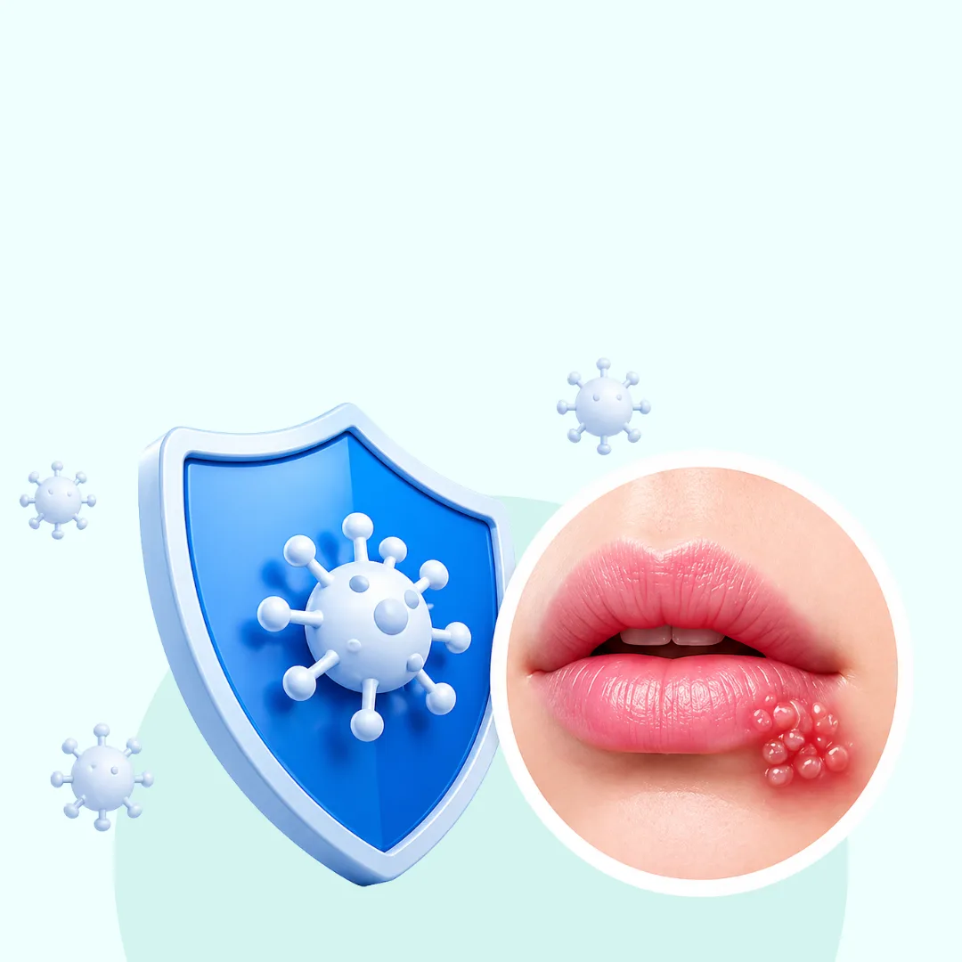 Herpes Simplex