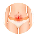 HSV tipe 2 - herpes genital
